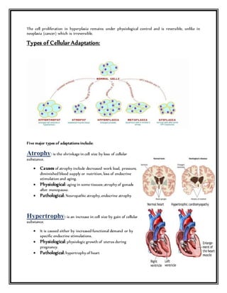 The cell proliferation in hyperplasia remains under physiological control and is reversible, unlike in
neoplasia (cancer) which is irreversible.
Types of Cellular Adaptation:
Five major types of adaptations include:
Atrophy: is the shrinkage in cell size by loss of cellular
substance.
 Causes of atrophy include decreased work load, pressure,
diminished blood supply or nutrition, loss of endocrine
stimulation and aging.
 Physiological: aging in some tissues; atrophy of gonads
after menopause.
 Pathological: Neuropathic atrophy, endocrine atrophy
Hypertrophy: is an increase in cell size by gain of cellular
substance.
 It is caused either by increased functional demand or by
specific endocrine stimulations.
 Physiological: physiologic growth of uterus during
pregnancy.
 Pathological: hypertrophy of heart
 