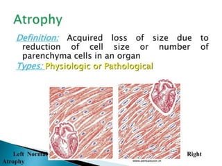 cellular adaptation physiological changes .pptx