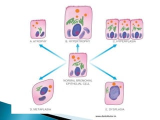 cellular adaptation physiological changes .pptx