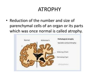 CELLULAR ADAPTATION atrophy hypertro.phy