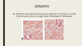 CELLULAR ADAPTATION PATHOLOGY PPT FOR RESIDENTS | PPTX