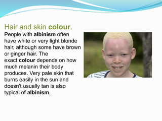 Hair and skin colour.
People with albinism often
have white or very light blonde
hair, although some have brown
or ginger hair. The
exact colour depends on how
much melanin their body
produces. Very pale skin that
burns easily in the sun and
doesn't usually tan is also
typical of albinism.
 