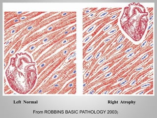 Cellular Adaptation & abbrent cell growth.pptx