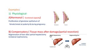 Examples:
1) Physiological-
A)Hormonal ( functional capacity)
Proliferation of glandular epithelium of
female breast at puberty & during pregnancy
B) Compensatory ( Tissue mass after damage/partial resection)
Regeneration of liver after partial hepatectomy
Unilateral nephrectomy
 