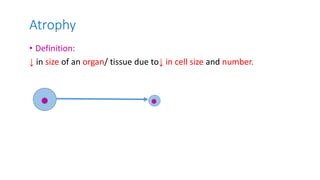 Atrophy
• Definition:
↓ in size of an organ/ tissue due to↓ in cell size and number.
 