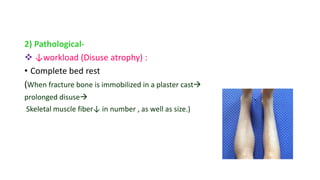 2) Pathological-
 ↓workload (Disuse atrophy) :
• Complete bed rest
(When fracture bone is immobilized in a plaster cast
prolonged disuse
Skeletal muscle fiber↓ in number , as well as size.)
 