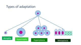 Types of adaptation
Atrophy Hypertrophy Hyperplasia Metaplasia
 