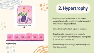Hypertrophy is an increase in the size of
parenchymal cells resulting in enlargement of
the affected organ or tissue.
Hypertrophy affects all types of muscles.
Dividing cells may respond to stress by
undergoing both hypertrophy and hyperplasia
(Uterine smooth muscle)
Non dividing cells undergo hypertrophy only
(Cardiac Muscle)
2. Hypertrophy
 