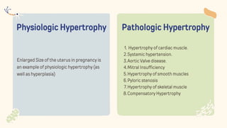 Physiologic Hypertrophy
Enlarged Size of the uterus in pregnancy is
an example of physiologic hypertrophy (as
well as hyperplasia)
Hypertrophy of cardiac muscle.
1.
Systemic hypertension.
2.
Aortic Valve disease.
3.
Mitral Insufficiency
4.
Hypertrophy of smooth muscles
5.
Pyloric stenosis
6.
Hypertrophy of skeletal muscle
7.
Compensatory Hypertrophy
8.
Pathologic Hypertrophy
 