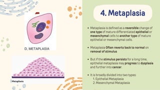 Metaplasia is defined as a reversible change of
one type of mature differentiated epithelial or
mesenchymal cells to another type of mature
epithelial or mesenchymal cells.
Metaplasia Often reverts back to normal on
removal of stimulus
But if the stimulus persists for a long time,
epithelial metaplasia may progress to dysplasia
and further into cancer.
It is broadly divided into two types:
1. Epithelial Metaplasia
2. Mesenchymal Metaplasia
4. Metaplasia
 
