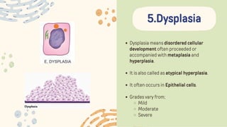 Dysplasia means disordered cellular
development often proceeded or
accompanied with metaplasia and
hyperplasia.
It is also called as atypical hyperplasia.
It often occurs in Epithelial cells.
Grades vary from;
Mild
Moderate
Severe
5.Dysplasia
 