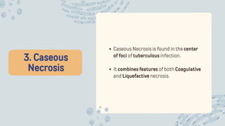 3. Caseous
Necrosis
Caseous Necrosis is found in the center
of foci of tuberculous infection.
It combines features of both Coagulative
and Liquefactive necrosis.
 