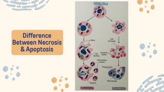 Difference
Between Necrosis
& Apoptosis
 