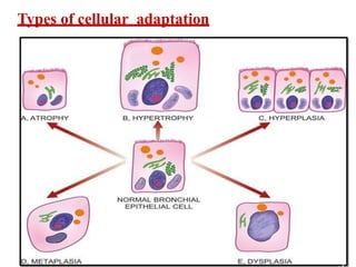 Cellular_adaptation_dr_AMAL_D_&_T_DR_AMAL_2023_lecture.pdf