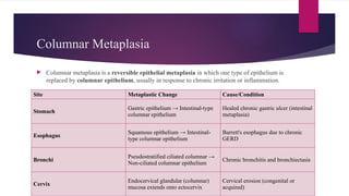 Columnar Metaplasia
 Columnar metaplasia is a reversible epithelial metaplasia in which one type of epithelium is
replaced by columnar epithelium, usually in response to chronic irritation or inflammation.
Site Metaplastic Change Cause/Condition
Stomach
Gastric epithelium → Intestinal-type
columnar epithelium
Healed chronic gastric ulcer (intestinal
metaplasia)
Esophagus
Squamous epithelium → Intestinal-
type columnar epithelium
Barrett's esophagus due to chronic
GERD
Bronchi
Pseudostratified ciliated columnar →
Non-ciliated columnar epithelium
Chronic bronchitis and bronchiectasis
Cervix
Endocervical glandular (columnar)
mucosa extends onto ectocervix
Cervical erosion (congenital or
acquired)
 