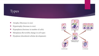 Types
 Atrophy (Decrease in size)
 Hypertrophy (Increase in size)
 Hyperplasia (Increase in number of cells)
 Metaplasia (Reversible change in cell type)
 Dysplasia (disordered cellular development)
 
