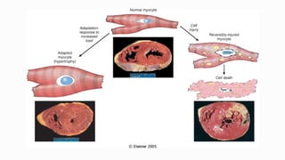 Anatomy of CELLULAR CHANGES AND ADAPTATIONS.ppt