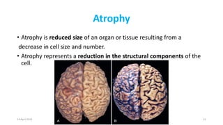 Cellular injury and adaptation | PPTX
