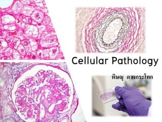 Cellular Pathology
พิษณุ ดวงกระโทก
 
