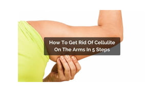 Cellulite Treatment Centre
