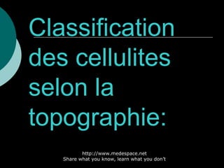 Classification des cellulites selon la topographie: http://www.medespace.net Share what you know, learn what you don’t 