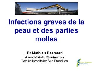 Infections graves de la
peau et des parties
molles
Dr Mathieu Desmard
Anesthésiste Réanimateur
Centre Hospitalier Sud Francilien
 