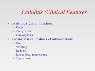 Cellulites [ compatibility mode].pptx