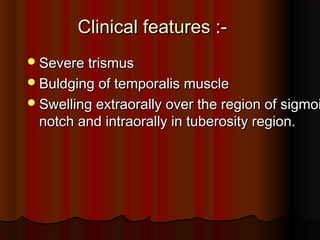 Clinical features :-Clinical features :-
Severe trismusSevere trismus
Buldging of temporalis muscleBuldging of temporalis muscle
Swelling extraorally over the region of sigmoiSwelling extraorally over the region of sigmoi
notch and intraorally in tuberosity region.notch and intraorally in tuberosity region.
 