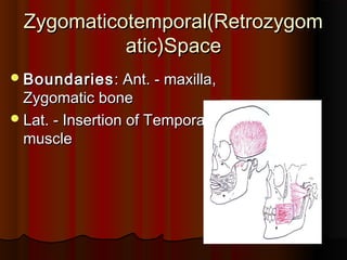 Zygomaticotemporal(RetrozygomZygomaticotemporal(Retrozygom
atic)Spaceatic)Space
BoundariesBoundaries: Ant. - maxilla,: Ant. - maxilla,
Zygomatic boneZygomatic bone
Lat. - Insertion of TemporalisLat. - Insertion of Temporalis
musclemuscle
 