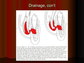 Drainage, con’tDrainage, con’t
 