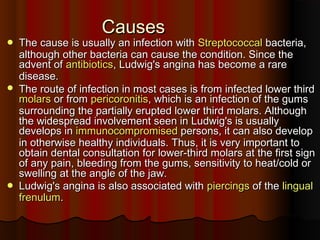 CausesCauses
 The cause is usually an infection withThe cause is usually an infection with StreptococcalStreptococcal bacteria,bacteria,
although other bacteria can cause the condition. Since thealthough other bacteria can cause the condition. Since the
advent ofadvent of antibioticsantibiotics, Ludwig's angina has become a rare, Ludwig's angina has become a rare
disease.disease.
 The route of infection in most cases is from infected lower thirdThe route of infection in most cases is from infected lower third
molarsmolars or fromor from pericoronitispericoronitis, which is an infection of the gums, which is an infection of the gums
surrounding the partially erupted lower third molars. Althoughsurrounding the partially erupted lower third molars. Although
the widespread involvement seen in Ludwig's is usuallythe widespread involvement seen in Ludwig's is usually
develops indevelops in immunocompromisedimmunocompromised persons, it can also developpersons, it can also develop
in otherwise healthy individuals. Thus, it is very important toin otherwise healthy individuals. Thus, it is very important to
obtain dental consultation for lower-third molars at the first signobtain dental consultation for lower-third molars at the first sign
of any pain, bleeding from the gums, sensitivity to heat/cold orof any pain, bleeding from the gums, sensitivity to heat/cold or
swelling at the angle of the jaw.swelling at the angle of the jaw.
 Ludwig's angina is also associated withLudwig's angina is also associated with piercingspiercings of theof the linguallingual
frenulumfrenulum..
 
