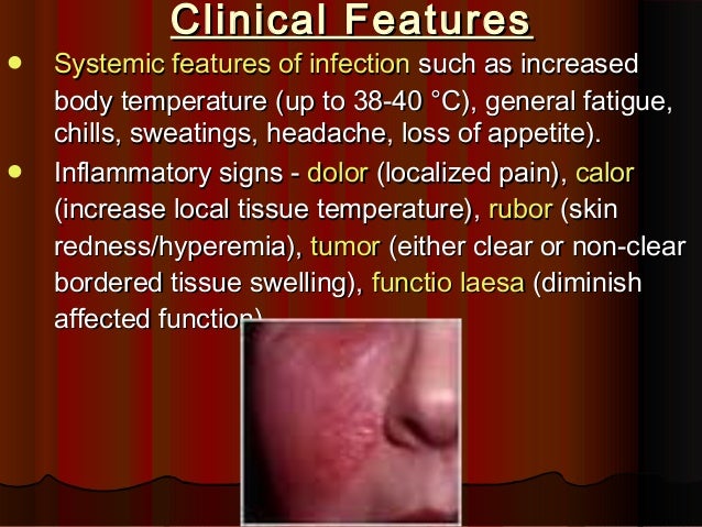 Cellulitis clinical manifestations