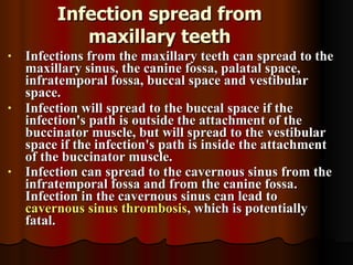 Palatal Infection spread of oral infections | PPT