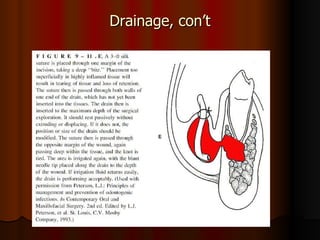 spread of oral infections Slide 73