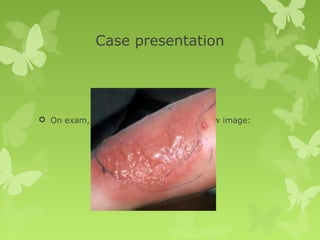 Case presentation
 On exam, his left leg is seen on the below image:
 