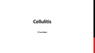Cellulitis
Ni’maBader
 