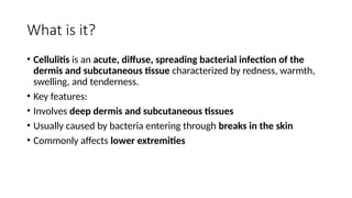 Comprehensive Overview of Cellulitis: Causes, Symptoms, and Management ...
