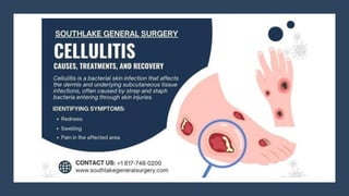 Cellulitis In Tagalog Cellulitis - Causes, Treatments, and Recovery.pdf