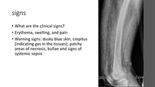cellulitis and burn.pptx