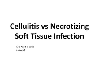 Cellulitis vs Necrotizing
Soft Tissue Infection
Afiq Azri bin Zakri
1110252
 