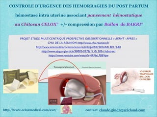 CONTROLE D’URGENCE DES HEMORRAGIES DU POST PARTUM
!
hémostase intra uterine associant pansement hémostatique
!
au Chitosan CELOX° +/- compression par Ballon de BAKRI°
PROJET ETUDE MULTICENTRIQUE PROSPECTIVE OBSERVATIONNELLE « AVANT - APRES »
CHU DE LA REUNION http://www.chu-reunion.fr/
http://www.sciencedirect.com/science/article/pii/S075076581401168X
http://www.ajog.org/article/S0002-9378(11)01205-1/abstract
https://www.youtube.com/watch?v=lRNxLFB8Vqw
http://www.celoxmedical.com/eur/ contact claude.gindrey@icloud.com
 