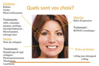 Quels sont vos choix? Épiderme: Ridules Taches Photovieillissement Traitements: AHA, rétinoïdes topiques, peelings, microdermabrasion , Microlaserpeel, relissage laser Derme: Perte du collagène Traitements: Remplissage de type collagène  . Photorajeunissement, Thermascan, Laserfacial, Muscles: Rides d'expression Traitement : BOTOX Cosmétique MC   Rides profondes Lifting non chirurgical Lifting 