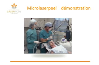 Microlaserpeel  démonstration 