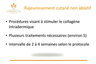 Rajeunissement cutané non ablatif Procédures visant à stimuler le collagène intradermique Plusieurs traitements nécessaires (environ 5) Intervalle de 2 à 4 semaines selon le protocole   