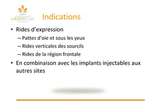 Indications Rides d’expression Pattes d’oie et sous les yeux Rides verticales des sourcils Rides de la région frontale En combinaison avec les implants injectables aux autres sites 