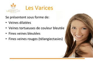 Les Varices Se présentent sous forme de: Veines dilatées  Veines tortueuses de couleur bleutée Fines veines bleutées Fines veines rouges (télangiectasies) 
