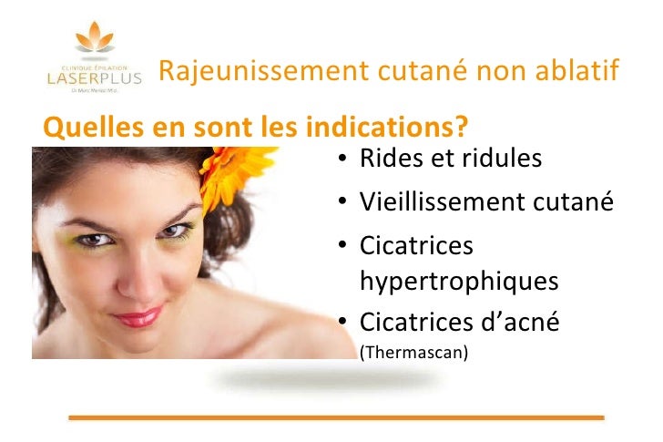 Les masques pour la personne avec lhuile du romarin
