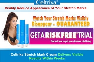Celtrixa Stretch Mark Cream Delivers Visible
Results Within Weeks
Visibly Reduce Appearance of Your Stretch Marks
 