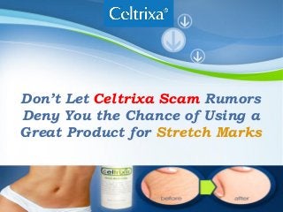 Powerpoint Templates
Page 1Powerpoint Templates
Don’t Let Celtrixa Scam Rumors
Deny You the Chance of Using a
Great Product for Stretch Marks
 