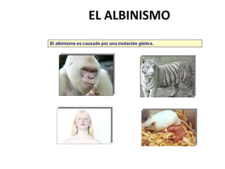 EL ALBINISMO
 